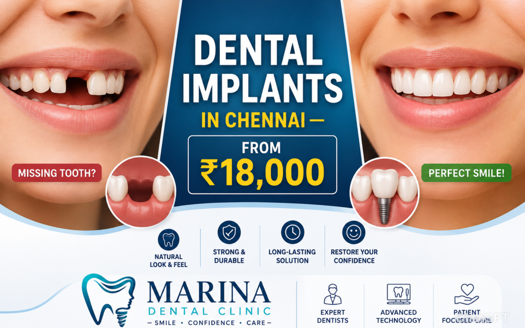 Dental Implant Cost in Chennai