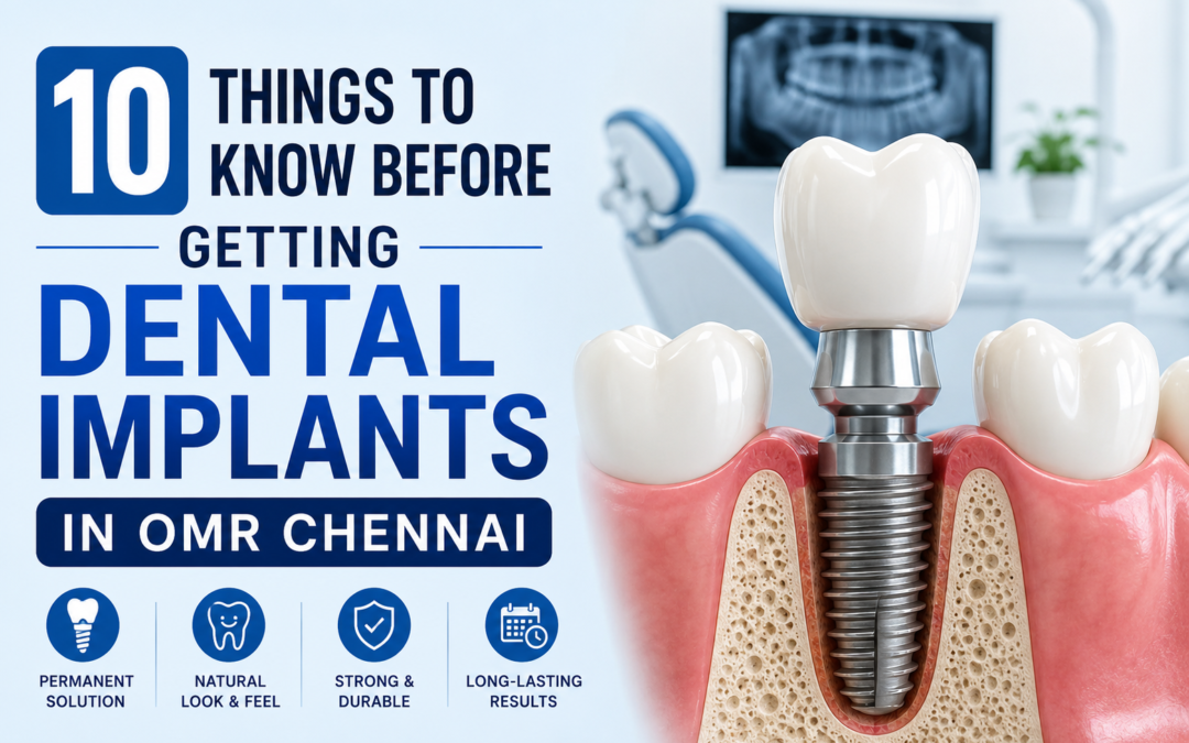 10 Things to Know Before Getting Dental Implants in OMR Chennai